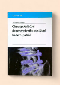 Chirurgická léčba degenerativního postižení bederní páteře