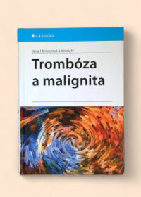 Trombóza a malignita