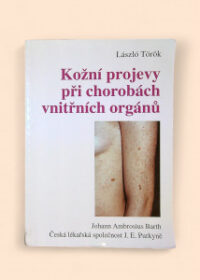 Kožní projevy při chorobách vnitřních orgánů