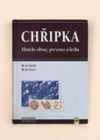 Chřipka