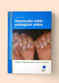 Onemocnění nehtů - patologické změny