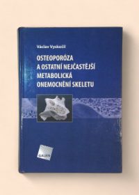 Osteoporóza a ostatní nejčastější metabolická onemocnění skeletu