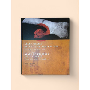 smrcka-vaclav-kuzelka-vitezslav-povysil-ctibor-atlas-chorob-na-kostnich-preparatech-2009.jpg Atlas chorob na kostních preparátech